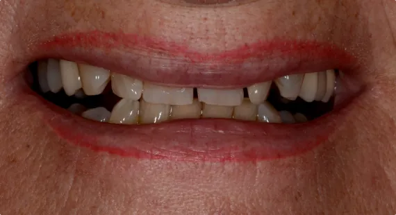 Case 1 — Before